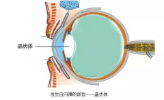 这种致盲眼病人人都会得，而“解药”只有一个